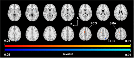 Fig 2.