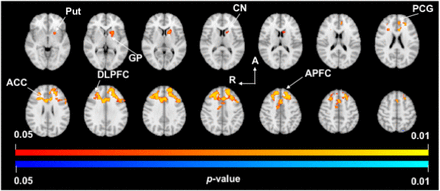 Fig 3.