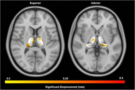 Fig 4.