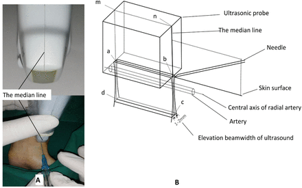 Figure 3: