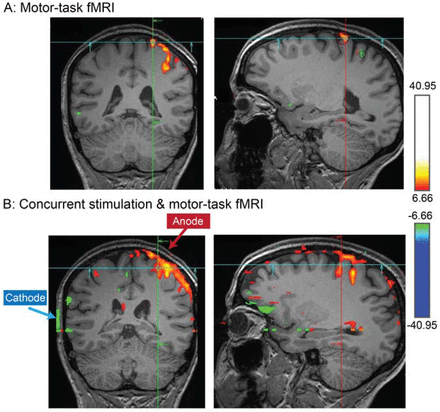 Figure 9: