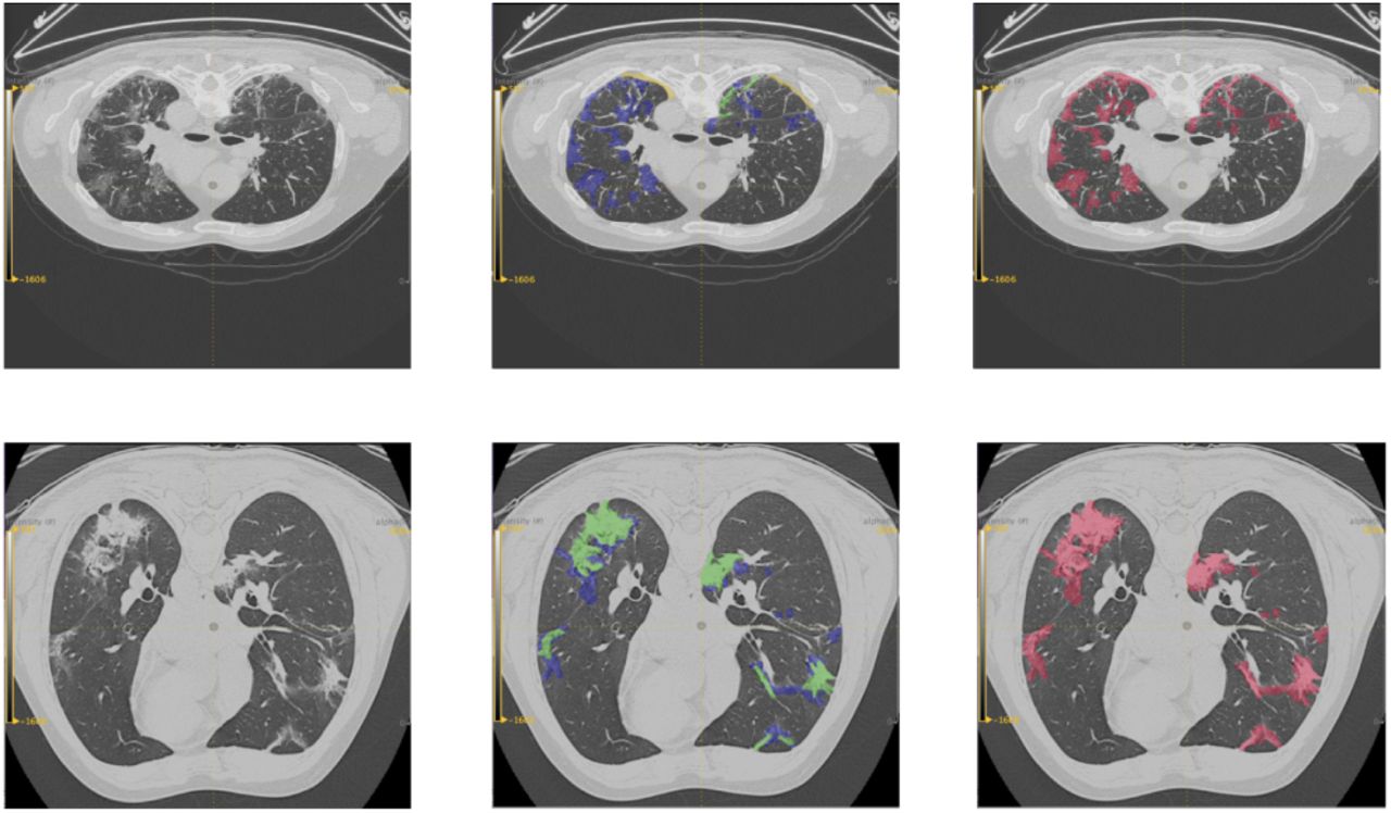 Deep learning-based segmentation of the thorax in mouse micro-CT scans