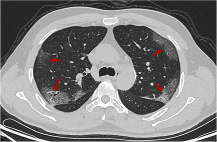 Figure 2B,