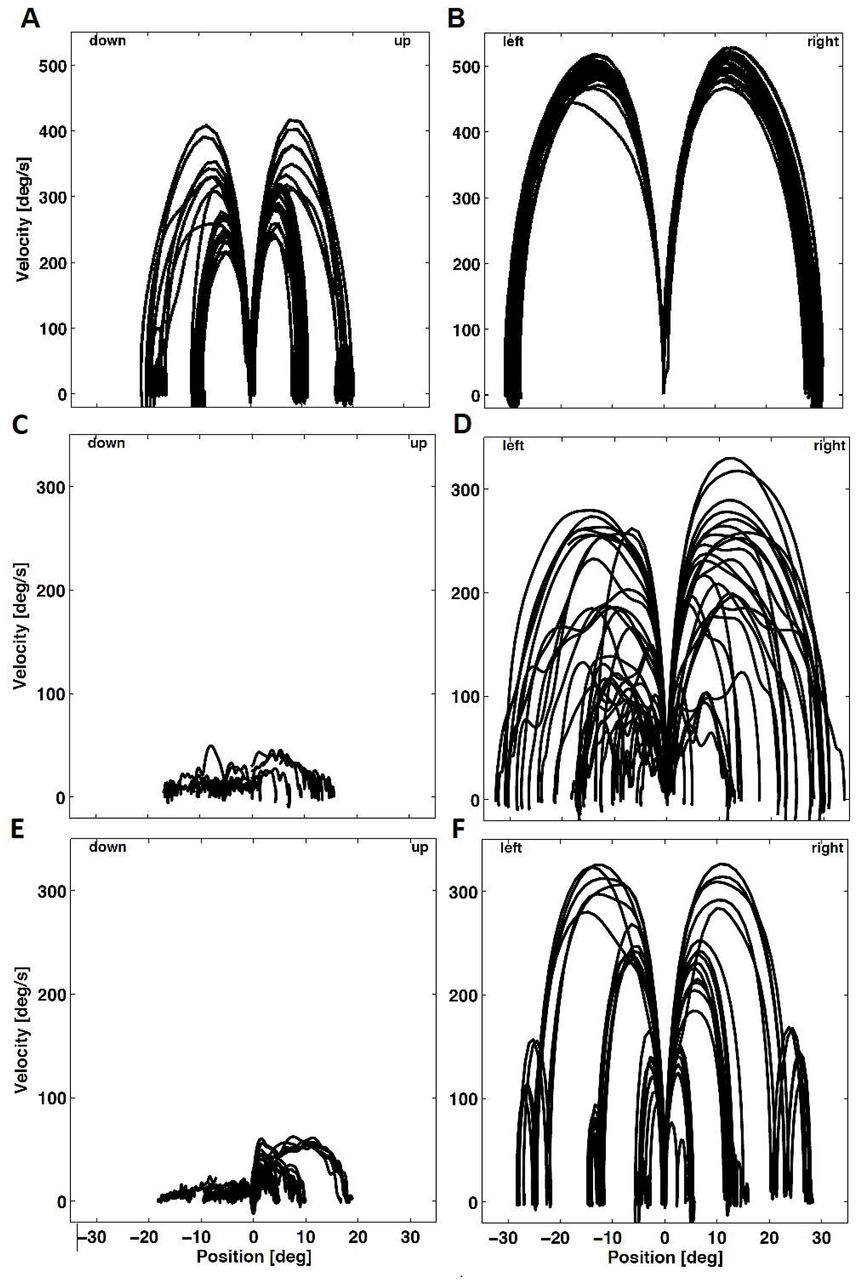 Potential treatment for Niemann-Pick type C, a rare neurodegenerative  disease