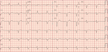 Supplemental Figure 3.