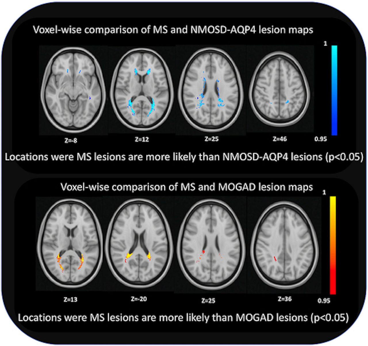 Imaging Surrogates of Disease Activity in Neuromyelitis Optica Allow  Distinction from Multiple Sclerosis