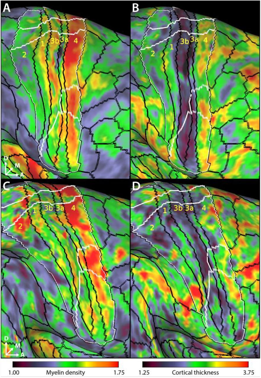 Frontiers  Somatotopic Mapping of the Fingers in the