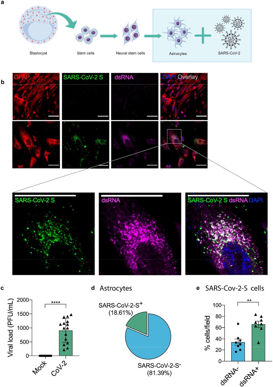 Sars Cov 2 Infects Brain Astrocytes Of Covid 19 Patients And Impairs Neuronal Viability Medrxiv