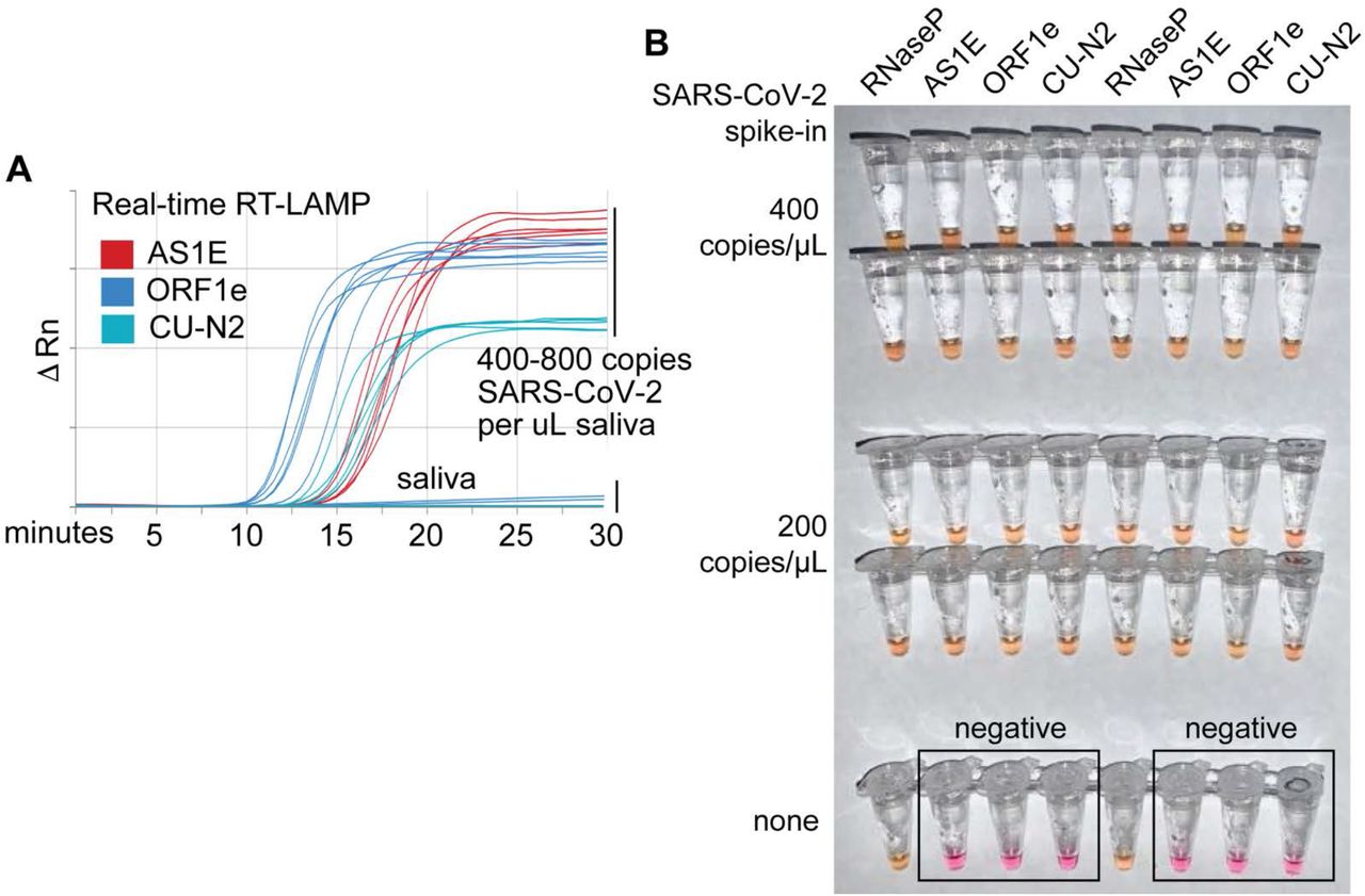 Optimized RT-LAMP primer sets for detecting SARS-CoV-2 in human saliva. A) Three RT-LAMP primer sets targeting the SARS-CoV-2 genome (AS1E ( Rabe and Cepko, 2020 ), ORF1e, and CU-N2) were tested with real-time RT-LAMP. Saliva was mixed 1:1 with 2X saliva stabilization solution, heated at 95°C for 10 minutes, and then spiked with in vitro transcribed SARS-CoV-2 RNA at the indicated concentrations. 4 μL of this was added to a master mix containing primers and NEB’s WarmStart LAMP 2x Master Mix in a final reaction volume of 20 μL. Reactions were incubated at 65°C and a fluorescence reading was taken every 30 seconds. EvaGreen was used to monitor amplification products in real-time (X-axis) using a QuantStudio3 quantitative PCR machine. There are 9 lines for each of the three primer sets because three concentrations of spiked in SARS-CoV-2 RNA were each tested in triplicate (0, 400, 800 copies / μL saliva). The saliva samples without SARS-CoV-2 RNA spike in are shown as flat lines. When concentrations are given herein, denominator refers to the raw, pre-diluted saliva sample. The normalized change in fluorescence signal (ΔRn) is shown on the Y-axis. B) Saliva mixed 1:1 with 2X saliva stabilization solution was heated (95°C for 10 minutes) and then spiked with SARS-CoV-2 RNA at the indicated concentrations. Replicates were tested by RT-LAMP with the control RNaseP primer set and three distinct SARS-CoV-2 primer sets (AS1E, ORF1e, and CU-N2). All samples scored positive except those boxed, which are saliva samples that contain no SARS-CoV-2 RNA, as expected. 