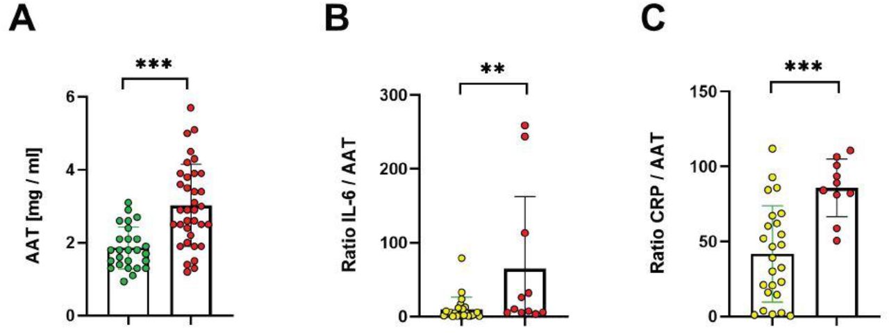 Alpha 1 Antitrypsin is an Inhibitor of the SARS-CoV-2–Priming