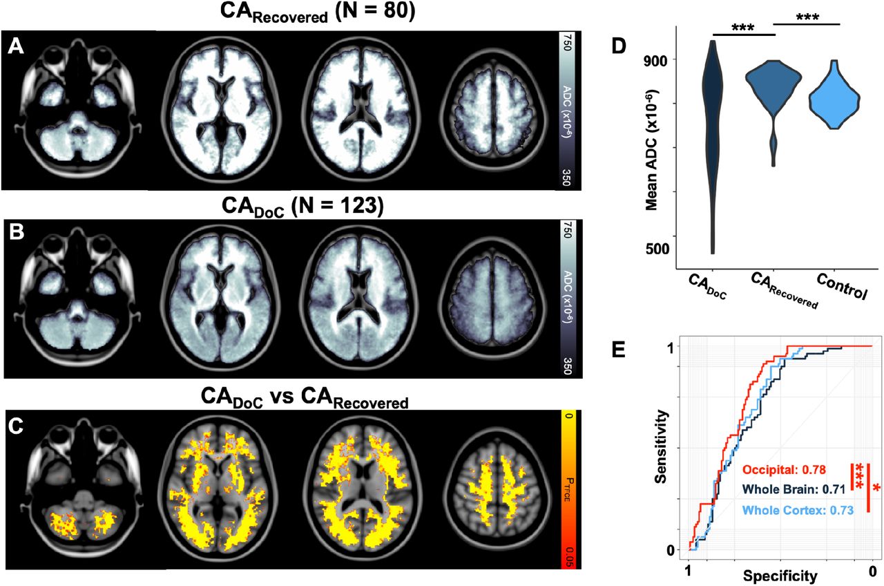 Brain Hypoxia Is Associated With Neuroglial Injury in Humans Post–Cardiac  Arrest