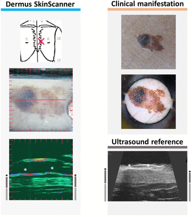 Figure 10.