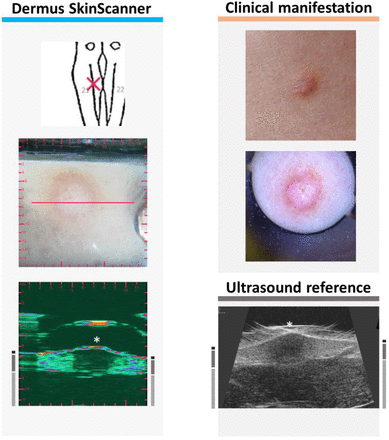 Figure 12.