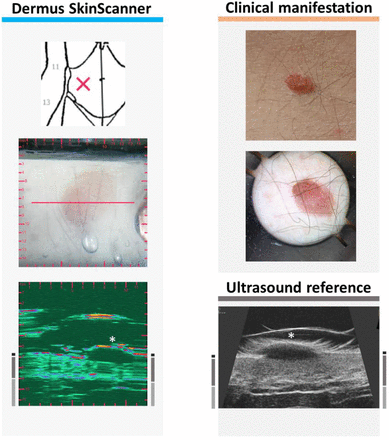 Figure 14.