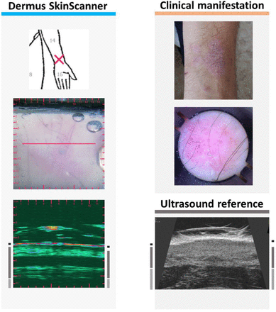 Figure 20.