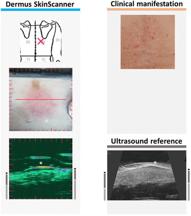 Figure 21.