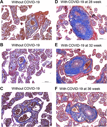 Figure 3: