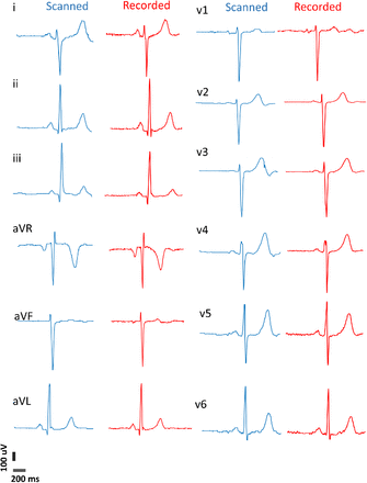 Figure 11.