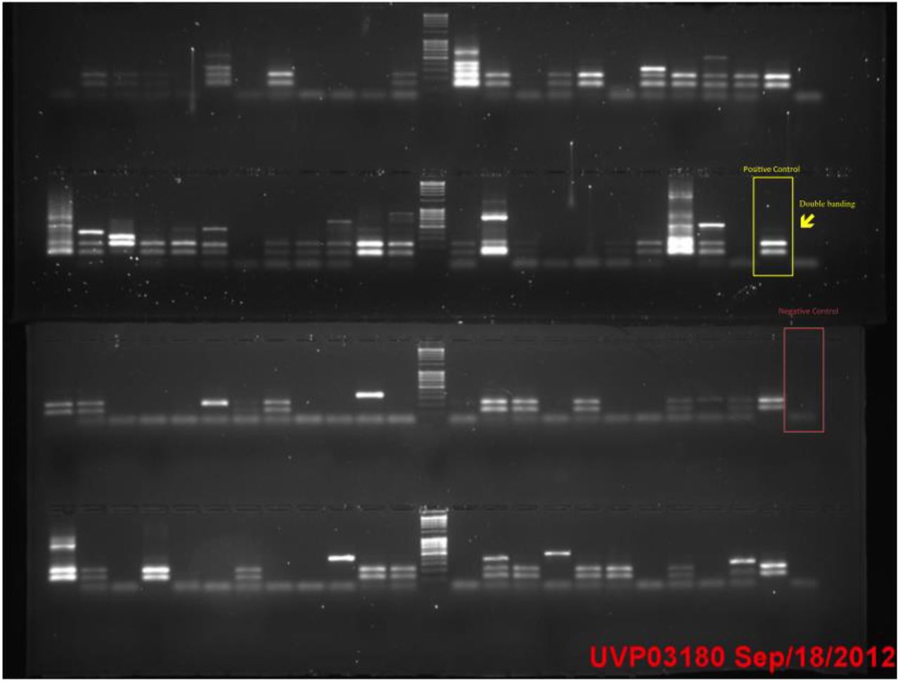 E7 PCR using <t>Invitrogen</t> <t>Taq.</t> Yellow box highlights the double banding in positive samples showing an unexpected fragment. 