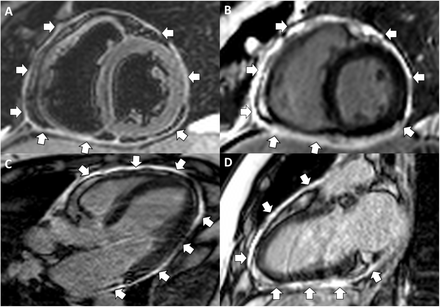 Fig 5.