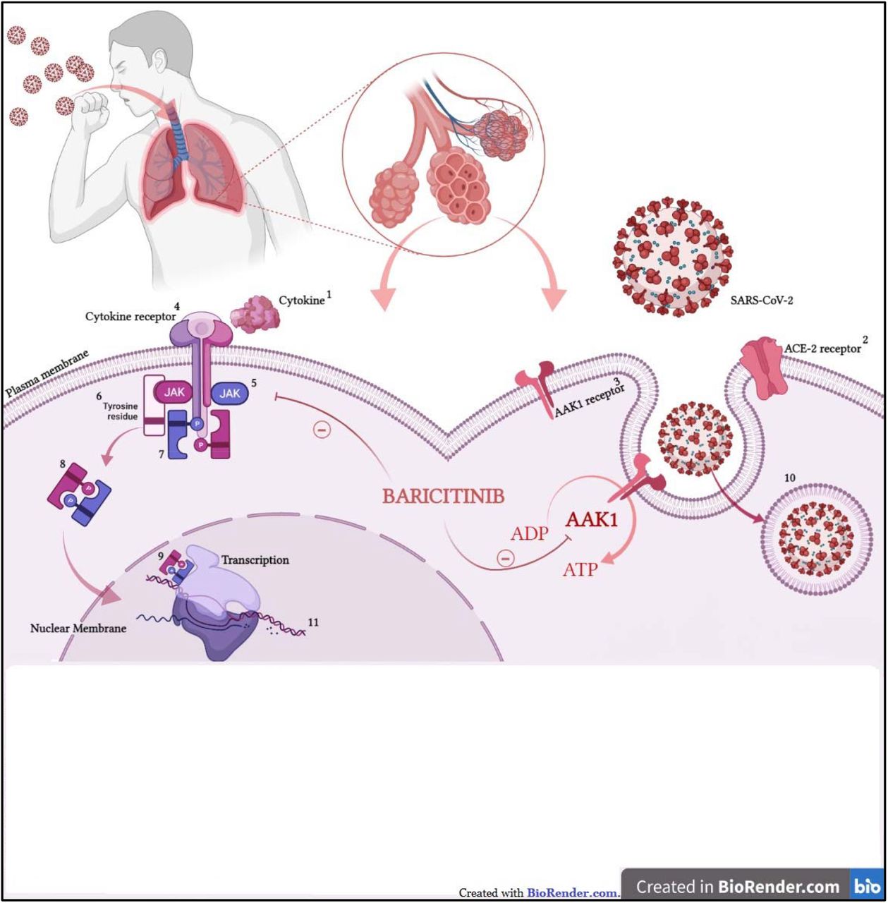 Experience With the Use of Baricitinib and Tocilizumab Monotherapy or  Combined, in Patients With Interstitial Pneumonia Secondary to Coronavirus  COVID19: A Real-World Study