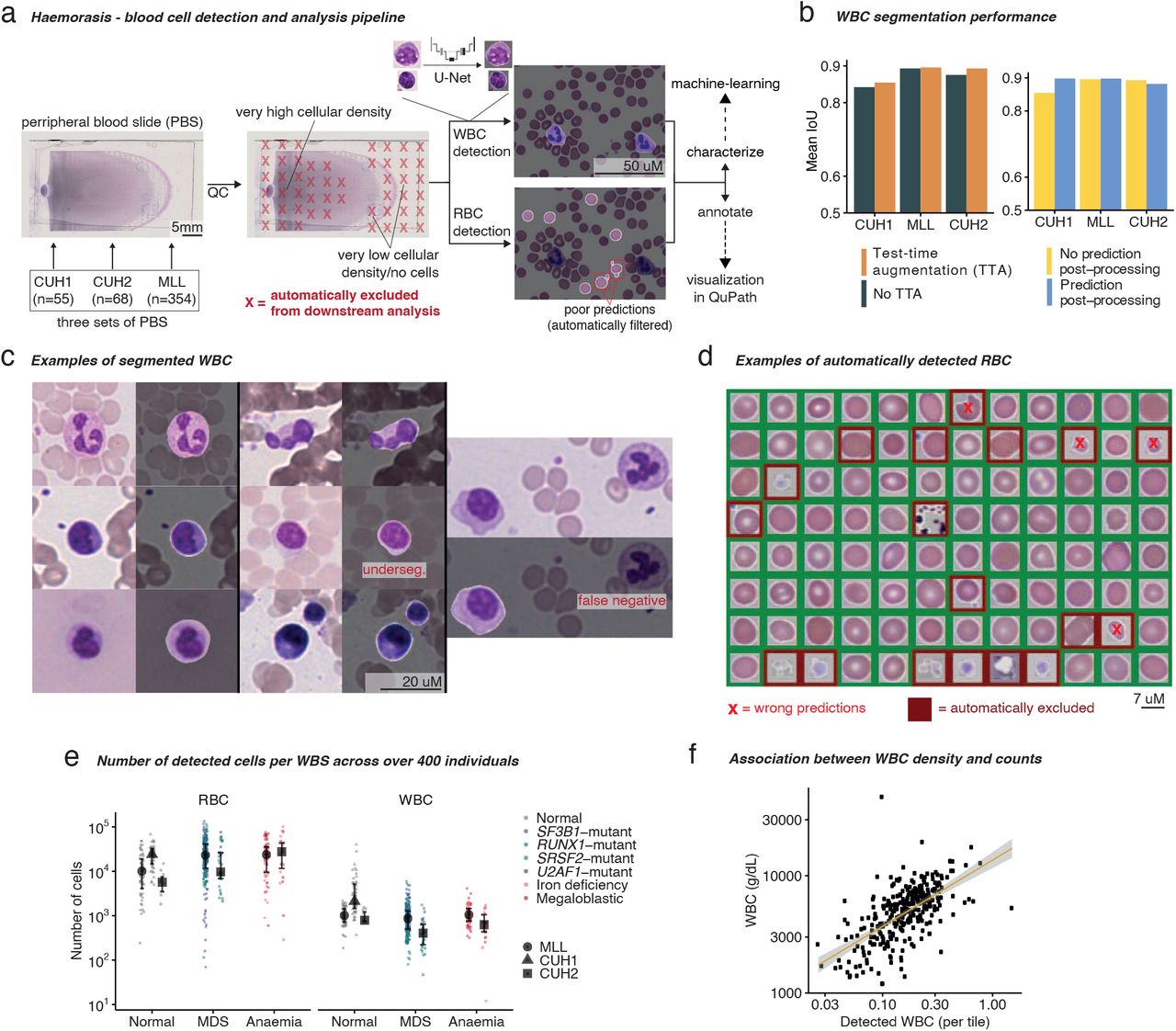 U-Net: deep learning for cell counting, detection, and morphometry