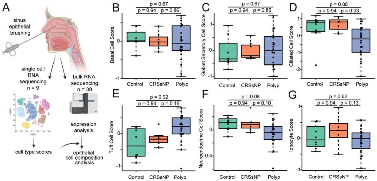 IL-13 associated epithelial remodeling correlates with clinical severity in nasal polyposis medRxiv pic